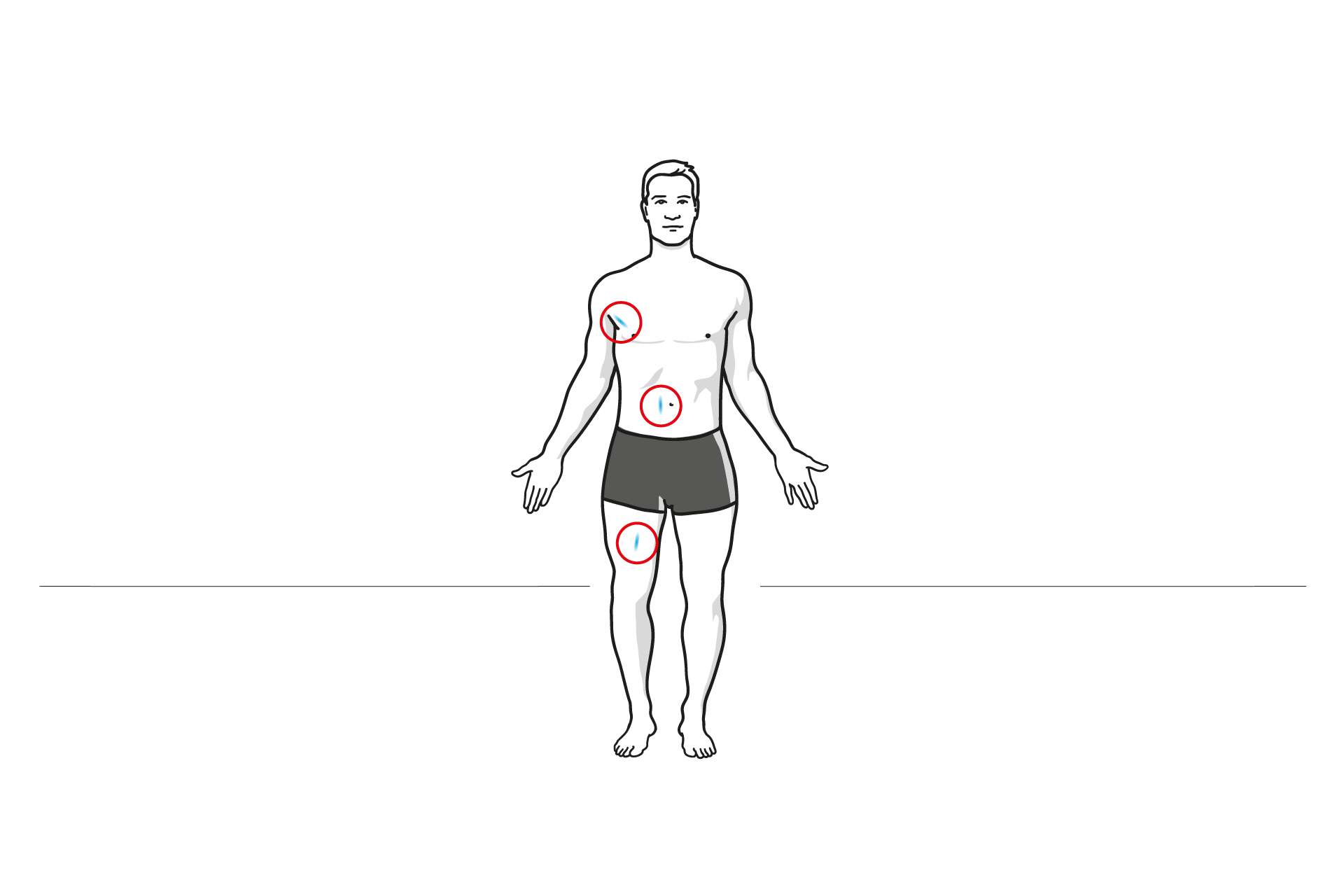 Illustration zur Körperfettmessung