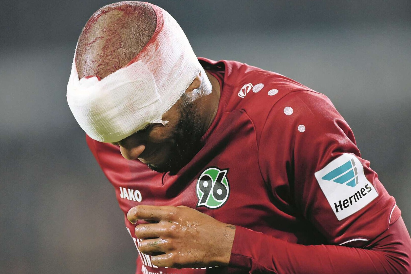 Am Kopf verletzter Fußballspieler mit Verband, 

Kopfverletzung Jimmy Briand, Fußball Bundesliga, Hannover 96 - Eintracht Frankfurt