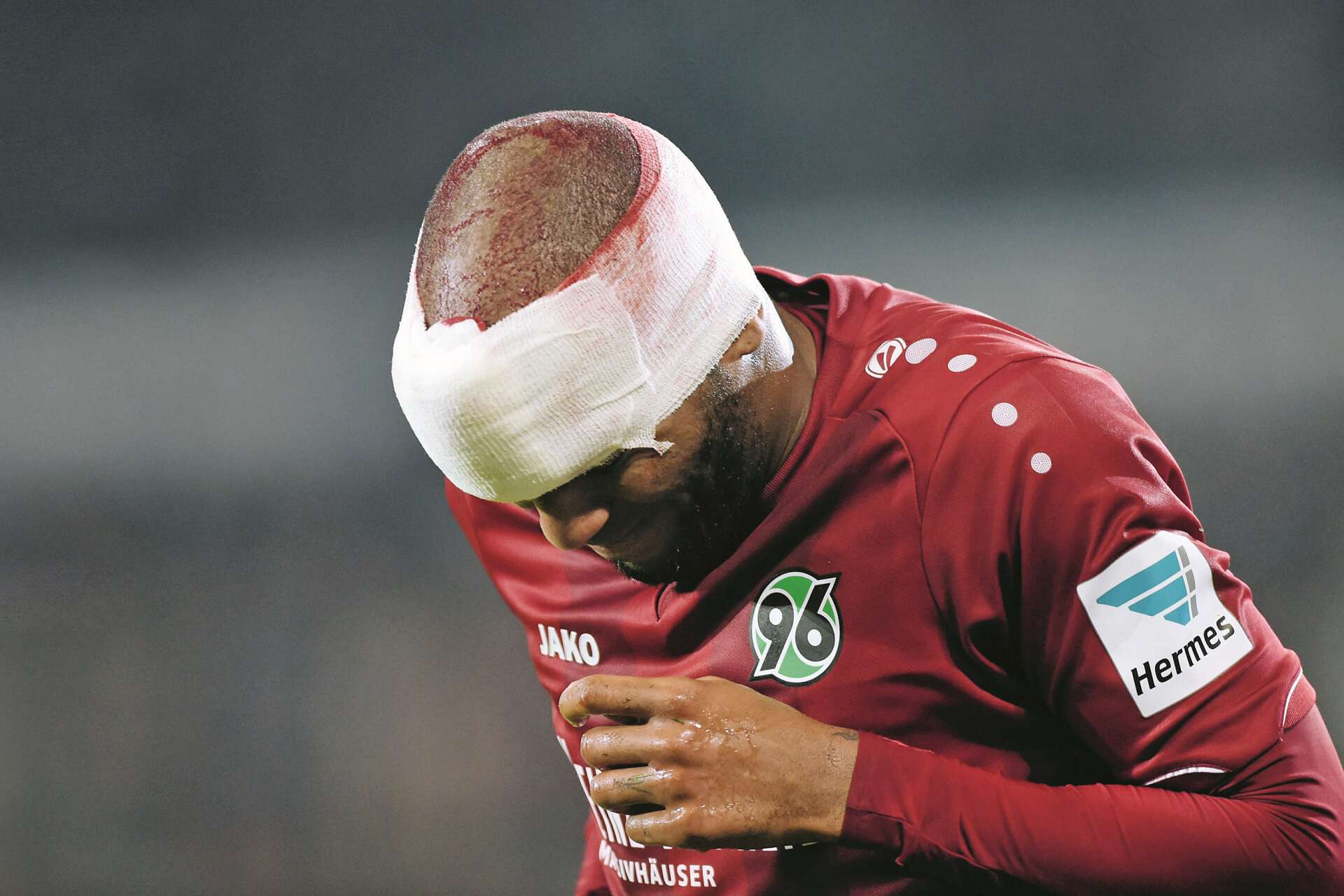 Am Kopf verletzter Fußballspieler mit Verband, Kopfverletzung Jimmy Briand (96) Fussball Bundesliga, Hannover 96 - Eintracht Frankfurt